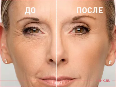 Ботокс (Botox) для волос в салоне - «Долго собиралась - быстро  разочаровалась. Как понять, подойдет ли вам процедура и сделаю ли я ботокс  для волос еще раз?» | отзывы