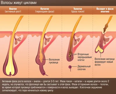 Вросшие волосы после шугаринга - что делать