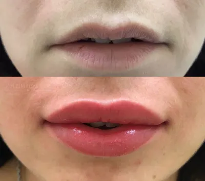 Татуаж губ: До и После 💋... - Перманентный макияж в Берлине | Facebook