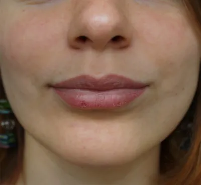 Татуаж губ - «Обновление каждые 2 года. Просто необходимая процедура,  которая вернет губам красоту и натуральность » | отзывы