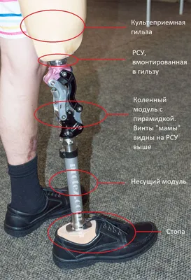 Стоимость протезов ног