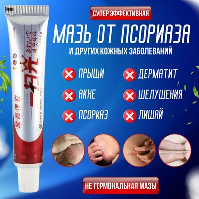 ПСОРИЗАН-Fito, крем от псориаза, экземы, дерматита - купить по выгодной  цене | Новая Эра - Пептиды в Казахстане