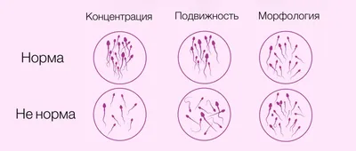 Сперматозоиды: что следует знать о них — Reprolife