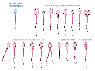 Сперматозоид: что это такое, строение сперматозоида, размер, скорость,  функции, созревание