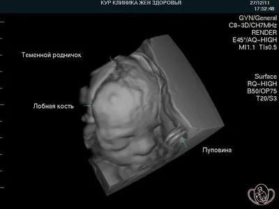 3D и 4D УЗИ при беременности в Челябинске - Медицинский центр «Добрый  Доктор»