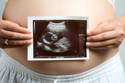 20 неделя беременности от зачатия: УЗИ плода, фото живота, что происходит с  мамой и малышом