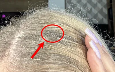 Наращивание Волос� - Многие сомневаются, возможно ли отрастить родную длину  волос с помощью наращивания? Их опасения вызваны тем, что долгая фиксация  донорского материала нарушит естественную красоту собственной шевелюры.  Поверьте, что всё это –