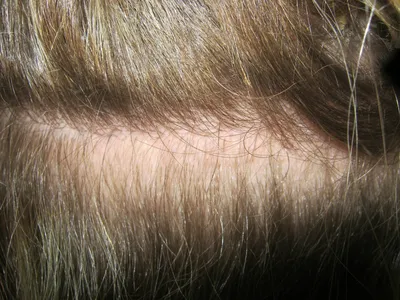 Коррекция волос, снятие волос (снятие нарощенных волос) в Днепропетровске, наращивание  волос, продажа волос. Украина. Подробно о наращивании волос