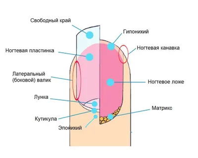 Вросший ноготь на ноге - как лечить