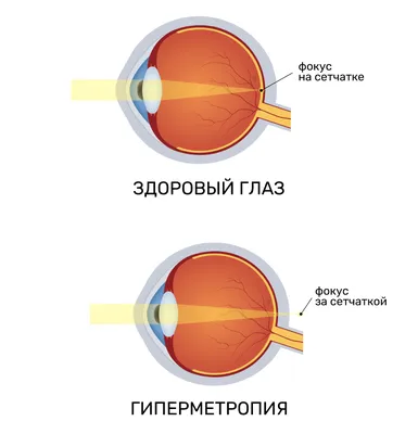 Как сохранить здоровье глаз?