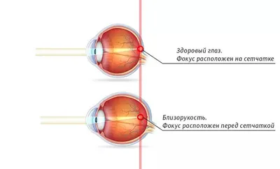 Прооперировали здоровый глаз ребенка\": алматинка обвинила врачей в  халатности - 08.04.2022, Sputnik Казахстан