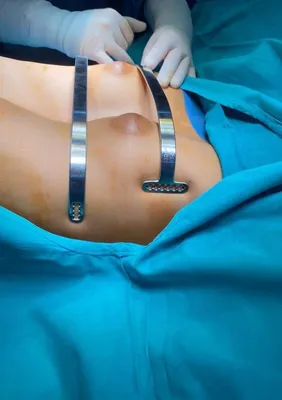 Реконструкция груди и молочной железы после рака груди по ОМС - клиника  Европа