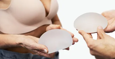 Удаление грудных имплантов – когда это нужно женщинам - Здоровье 24