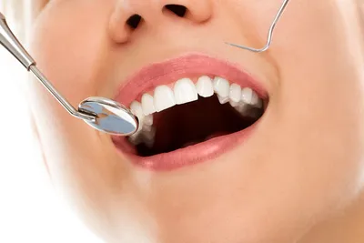 Лечение зубов - WinDent.ru - Официальный сайт стоматологии \"Windent\"
