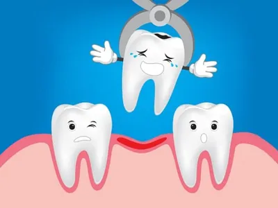 Отбеливание зубов в Стоматологической поликлинике № 29