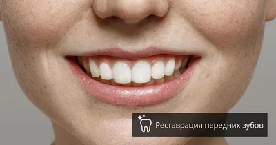 Реставрация передних зубов [виды и цены в Элидент, Москва]