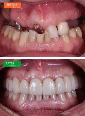 Желтые зубы причины и способы устранения желтизны зубов в Севастополе в  стоматологии | Жемчуг