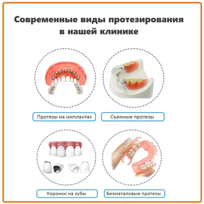 Имплантация и протезирование при наличии сверхкомплектных зубов