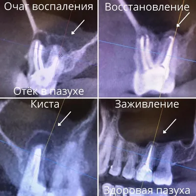 Компьютерная томогорафия придаточных пазух носа - фото - ЛОР в Самаре -  врач Лунёв Андрей Владимирович