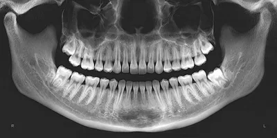 Панорамные снимки челюсти • Диагностический центр Вальдорф