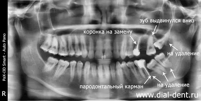 3D-диагностика челюстно-лицевой области и придаточных пазух носа в клинике  «Чайка» на Университете - Клиники Чайка