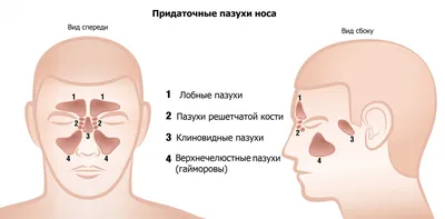 Прокол при гайморите - операция пункции пазух носа для лечения гайморита
