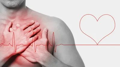 Сердечный приступ: как помочь близкому и самому себе? – Академический  медицинский центр (AMC) - медицинская клиника в самом центре Киева