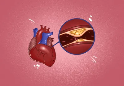 Как понять, что у ребенка больное сердце?