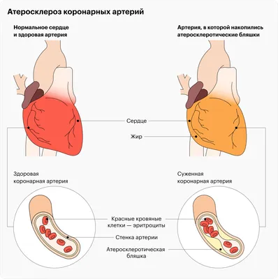 Лечение боли в левой груди в Екатеринбурге - Новая больница