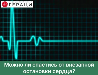 Боль в грудной клетке у женщин и мужчин: причины, лечение, профилактика в  домашних условиях