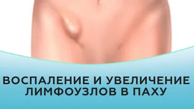 Увеличенные лимфоузлы. Вам к онкологу или к терапевту? | Клиника Рассвет