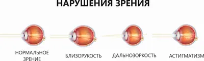 Строение глаза и функционирование зрительной системы