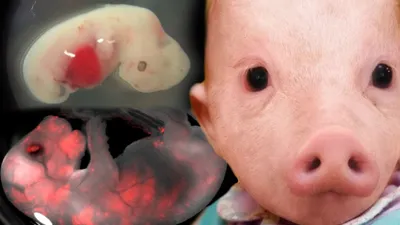 Свиное сердце: трансплантолог о перспективах пересадки органов от животных