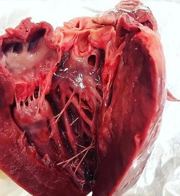 Маленькое человеческое сердце впервые создано из стволовых клеток -  Российская газета
