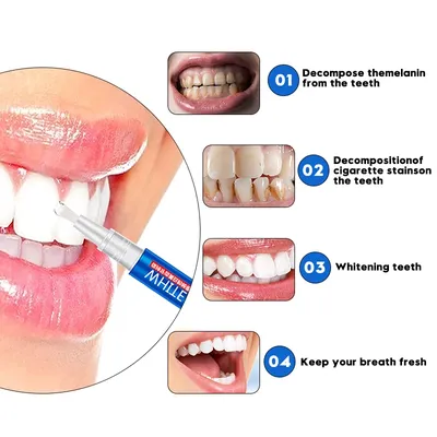Все методы отбеливания зубов