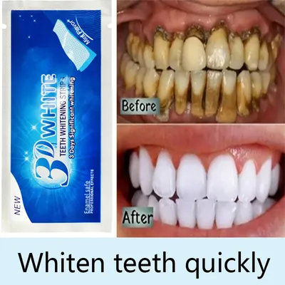 5D Гелевые полоски для отбеливания зубов, набор для отбеливания,  Гигиеничная уход за зубами, виниры для тандеров, виниры, Гелевые полоски |  AliExpress