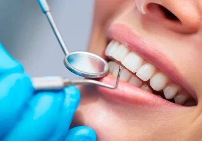 Система для отбеливания зубов Global White - купить в интернет-магазине  Улыбка радуги