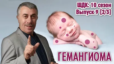 Гемангиома у ребенка — 14 ответов | форум Babyblog