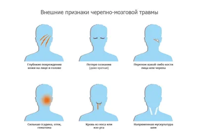 Травмы головы | Нейрохирург