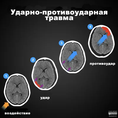 Плазмотерапия для волос —✔️ Центр эстетической медицины «Формула красоты»