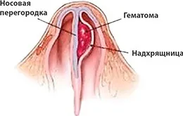 УЗИ головного мозга у ребенка