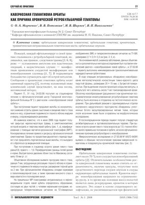 Как замаскировать самый настоящий СИНЯК под глазом. Мой опыт методом проб и  ошибок | Отзывы покупателей | Косметиста