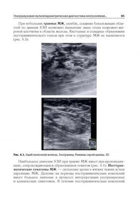 Иллюстрация 6 из 28 для Ультразвуковое мультипараметрическое исследование молочных  желез - Сенча, Фазылова, Евсеева | Лабиринт - книги. Источник: Лабиринт