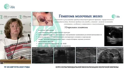 Биопсия молочной железы в медцентре «ОртоМед»