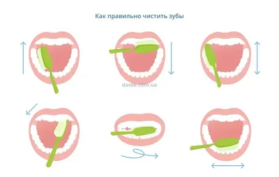 Гематома прорезывания | Записки Честного Стоматолога | Дзен