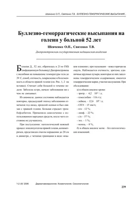 Буллезно-геморрагические высыпания на голени у больной 52 лет – тема  научной статьи по клинической медицине читайте бесплатно текст  научно-исследовательской работы в электронной библиотеке КиберЛенинка