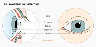 Сестринский уход при Заболеваниях КОНЪЮНКТИВы - презентация, доклад, проект