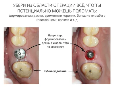 Где лечить зубы (стоматология)? - Форум onliner.by