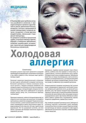 Крапивница: симптоми, діагностика та лікування у клініці Universum Clinic