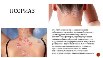 Детская дерматология Издательство Панфилова 38037128 купить за 979 000 сум  в интернет-магазине Wildberries
